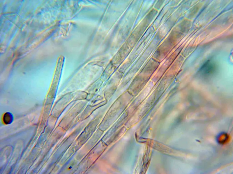 Agaricus xanthodermus 12 -  Hifas cutícula paralelas